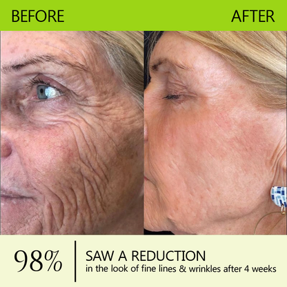 👩‍⚕️Made and shipped from IE ✅Healrize® Botox & Vita-A Retinol Shot Wrinkle-Lift Tightening cream - Last Day Promotion 70% OFF 🏆