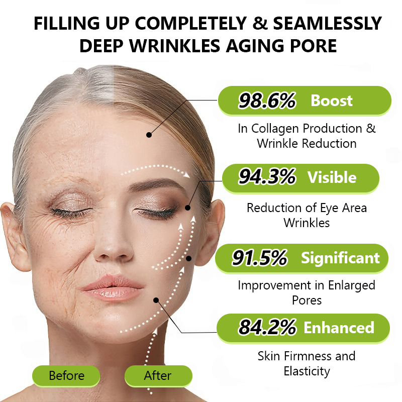 👩‍⚕️Made and shipped from IE ✅Healrize® Botox & Vita-A Retinol Shot Wrinkle-Lift Tightening cream - Last Day Promotion 70% OFF 🏆