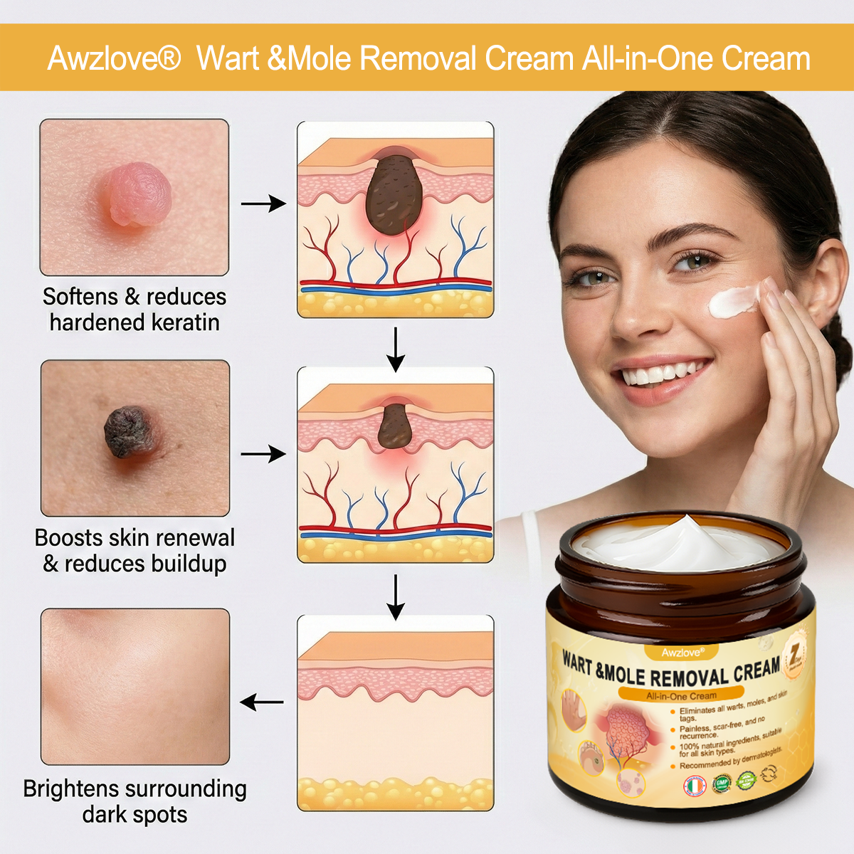🇮🇪 Made and Shipped from Ireland  ✅Awzlove® Wart &Mole Removal All-in-One Cream🏆