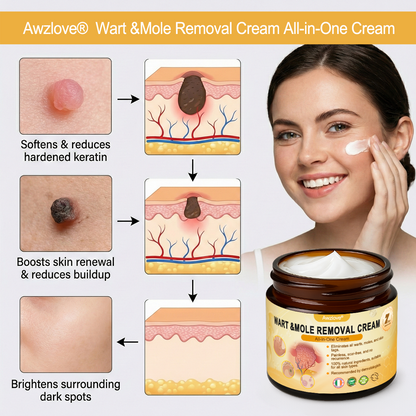 🇮🇪 Made and Shipped from Ireland  ✅Awzlove® Wart &Mole Removal All-in-One Cream🏆