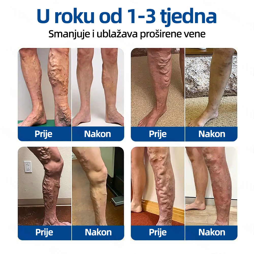 𝗛𝗲𝗮𝗹𝗿𝗶𝘇𝗲® 𝗩𝗲𝗶𝗻𝗧𝗮𝗿𝗴𝗲𝘁 𝗠𝗶𝗰𝗿𝗼𝗻𝗲𝗲𝗱𝗹𝗲 𝗣𝗮𝘁𝗰𝗵🌾🥬𝗜𝗻𝘀𝘁𝗮𝗻𝘁 𝗥𝗲𝗹𝗶𝗲𝗳, 𝗟𝗼𝗻𝗴-𝗧𝗲𝗿𝗺 𝗥𝗲𝘀𝘂𝗹𝘁𝘀✅🇮🇪