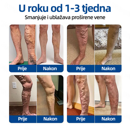 𝗛𝗲𝗮𝗹𝗿𝗶𝘇𝗲® 𝗩𝗲𝗶𝗻𝗧𝗮𝗿𝗴𝗲𝘁 𝗠𝗶𝗰𝗿𝗼𝗻𝗲𝗲𝗱𝗹𝗲 𝗣𝗮𝘁𝗰𝗵🌾🥬𝗜𝗻𝘀𝘁𝗮𝗻𝘁 𝗥𝗲𝗹𝗶𝗲𝗳, 𝗟𝗼𝗻𝗴-𝗧𝗲𝗿𝗺 𝗥𝗲𝘀𝘂𝗹𝘁𝘀✅🇮🇪