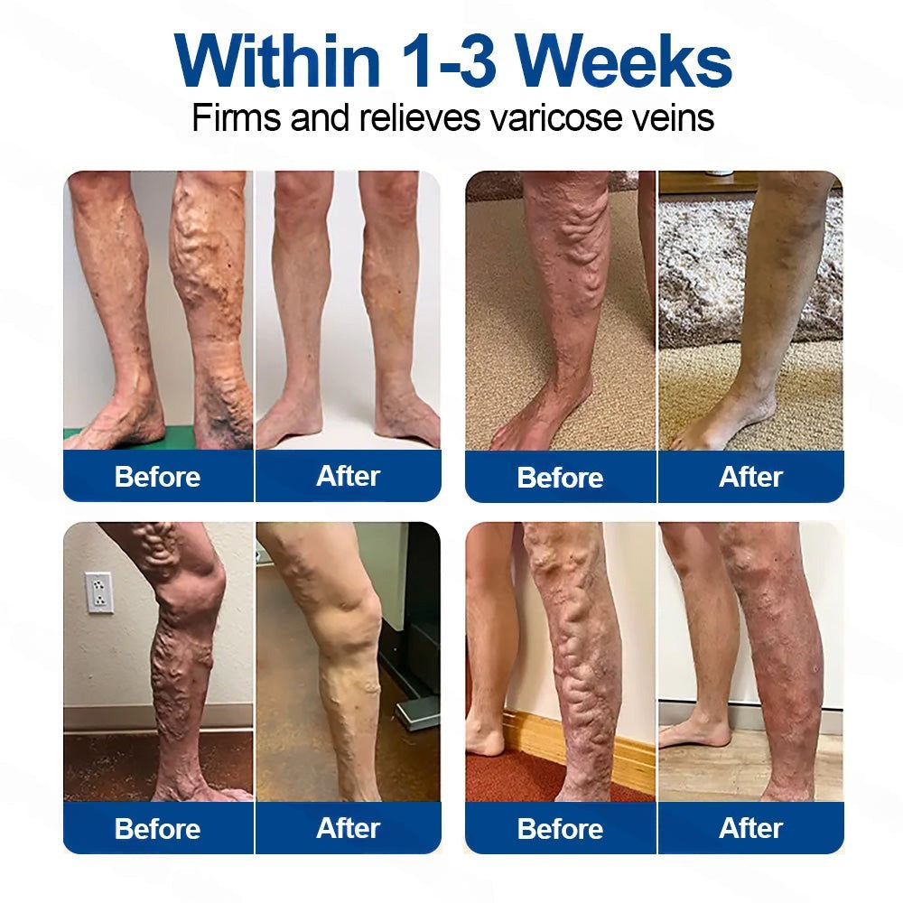 𝗛𝗲𝗮𝗹𝗿𝗶𝘇𝗲® 𝗩𝗲𝗶𝗻𝗧𝗮𝗿𝗴𝗲𝘁 𝗠𝗶𝗰𝗿𝗼𝗻𝗲𝗲𝗱𝗹𝗲 𝗣𝗮𝘁𝗰𝗵🌾🥬𝗜𝗻𝘀𝘁𝗮𝗻𝘁 𝗥𝗲𝗹𝗶𝗲𝗳, 𝗟𝗼𝗻𝗴-𝗧𝗲𝗿𝗺 𝗥𝗲𝘀𝘂𝗹𝘁𝘀✅🇮🇪