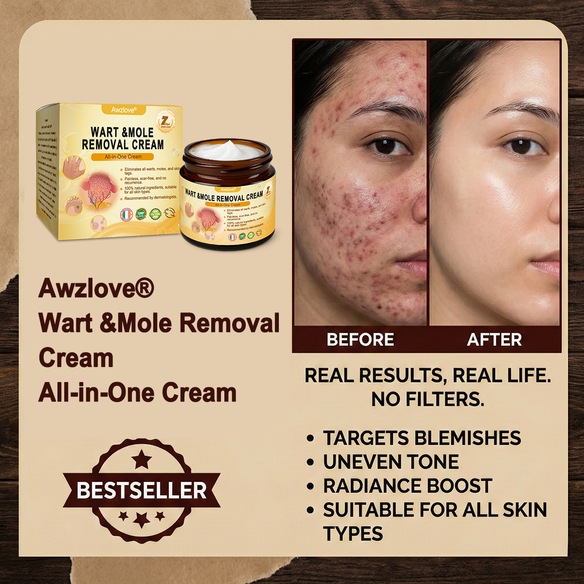 🇮🇪 Made and Shipped from Ireland  ✅Awzlove® Wart &Mole Removal All-in-One Cream🏆