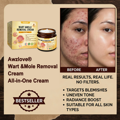 🇮🇪 Made and Shipped from Ireland  ✅Awzlove® Wart &Mole Removal All-in-One Cream🏆