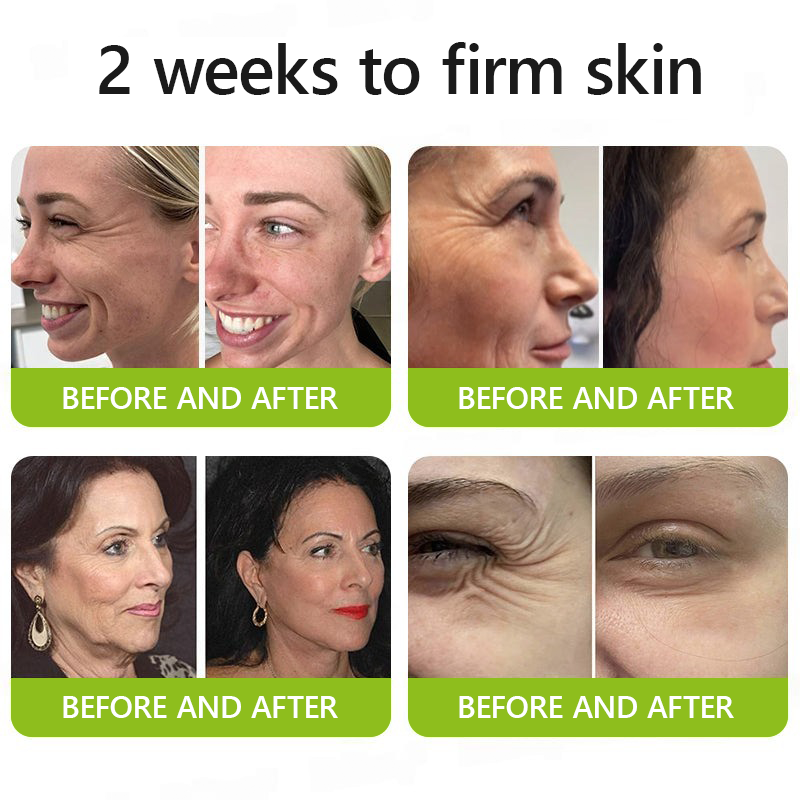👩‍⚕️Made and shipped from IE ✅Healrize® Botox & Vita-A Retinol Shot Wrinkle-Lift Tightening cream - Last Day Promotion 70% OFF 🏆
