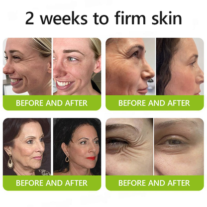 👩‍⚕️Made and shipped from IE ✅Healrize® Botox & Vita-A Retinol Shot Wrinkle-Lift Tightening cream - Last Day Promotion 70% OFF 🏆