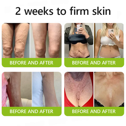 👩‍⚕️Made and shipped from IE ✅Healrize® Botox & Vita-A Retinol Shot Wrinkle-Lift Tightening cream - Last Day Promotion 70% OFF 🏆
