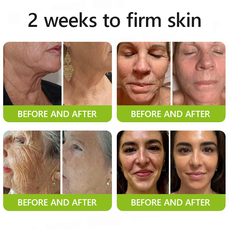 👩‍⚕️Made and shipped from IE ✅Healrize® Botox & Vita-A Retinol Shot Wrinkle-Lift Tightening cream - Last Day Promotion 70% OFF 🏆