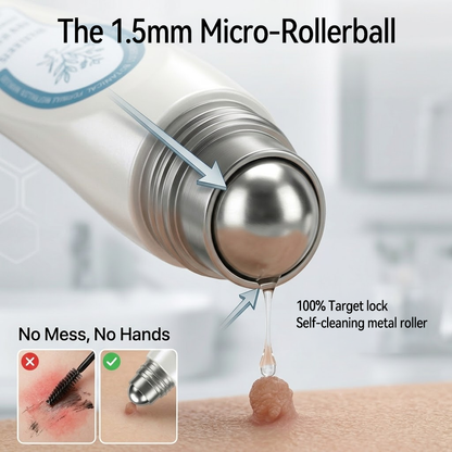 𝐇e𝐚𝐥𝐫i𝐳e® 7-𝐷𝑎𝑦 𝗧𝐚𝐠 & 𝗦𝗽𝐨𝐭 𝐄𝐫𝒂𝒔𝒆𝒓(Zero Pain, Zero 𝐒𝐜𝐚𝒓𝒔 Rollerball) 🚚